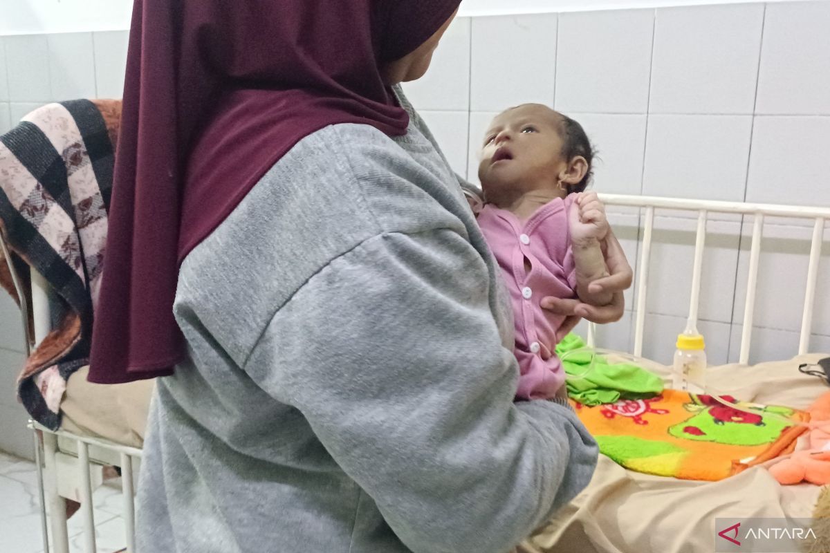 Pemkab Cianjur tanggung biaya pengobatan bayi 3 bulan penderita gizi buruk