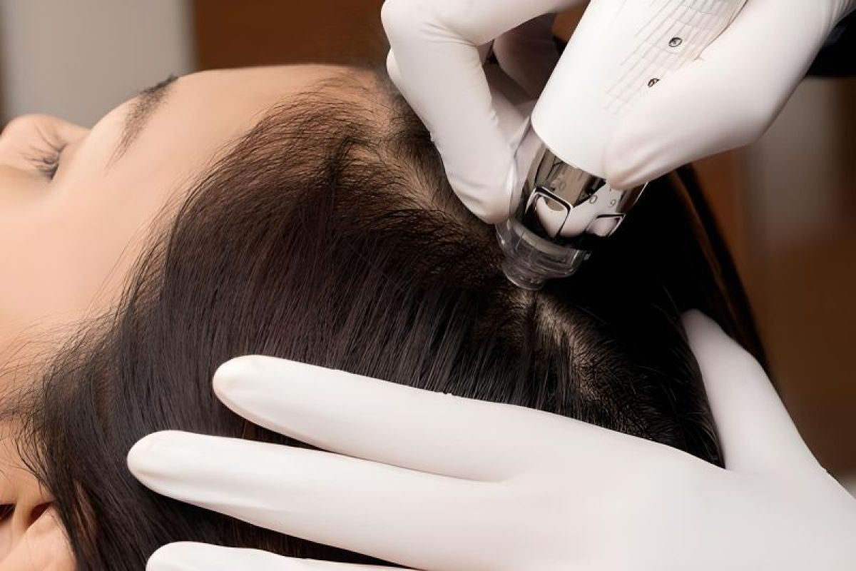 Tren perawatan kulit kepala untuk kesehatan dan pertumbuhan rambut