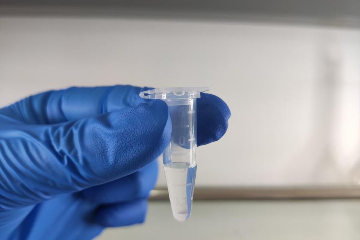 Peneliti kembangkan perangkat nano DNA pintar untuk trombolisis akurat