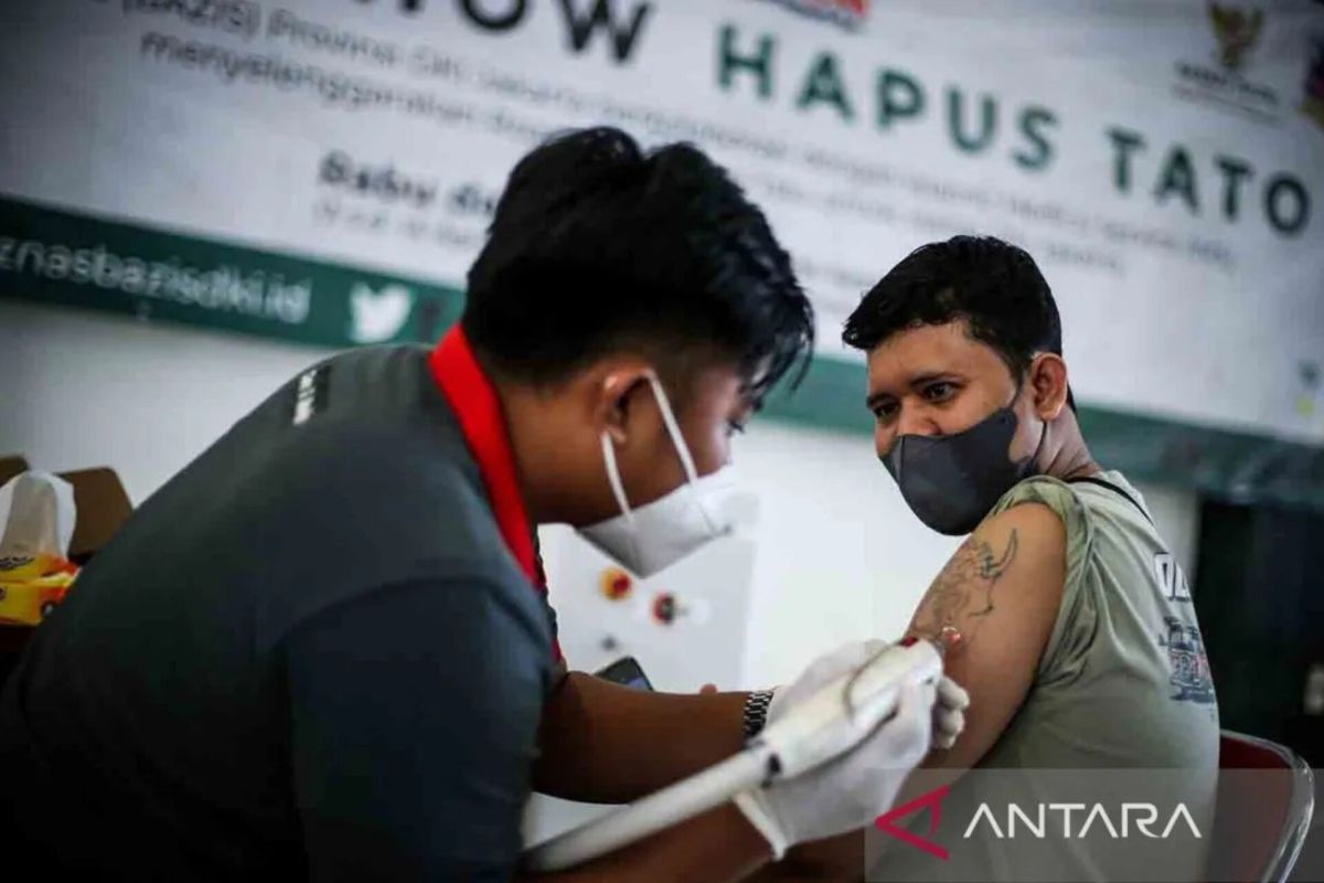 DKI diingatkan untuk awasi aspek higienis alat hapus tato gratis