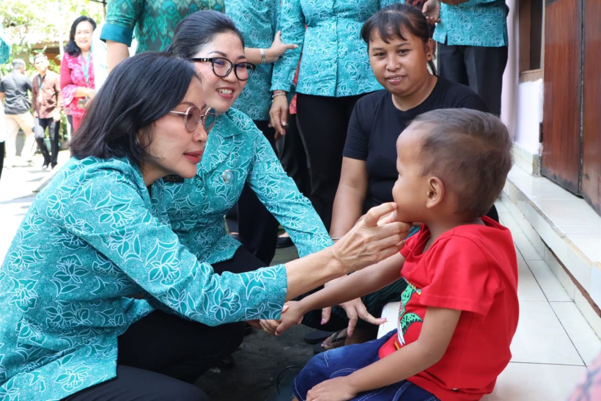 PKK Bali fokuskan kesehatan gigi anak untuk antisipasi stunting