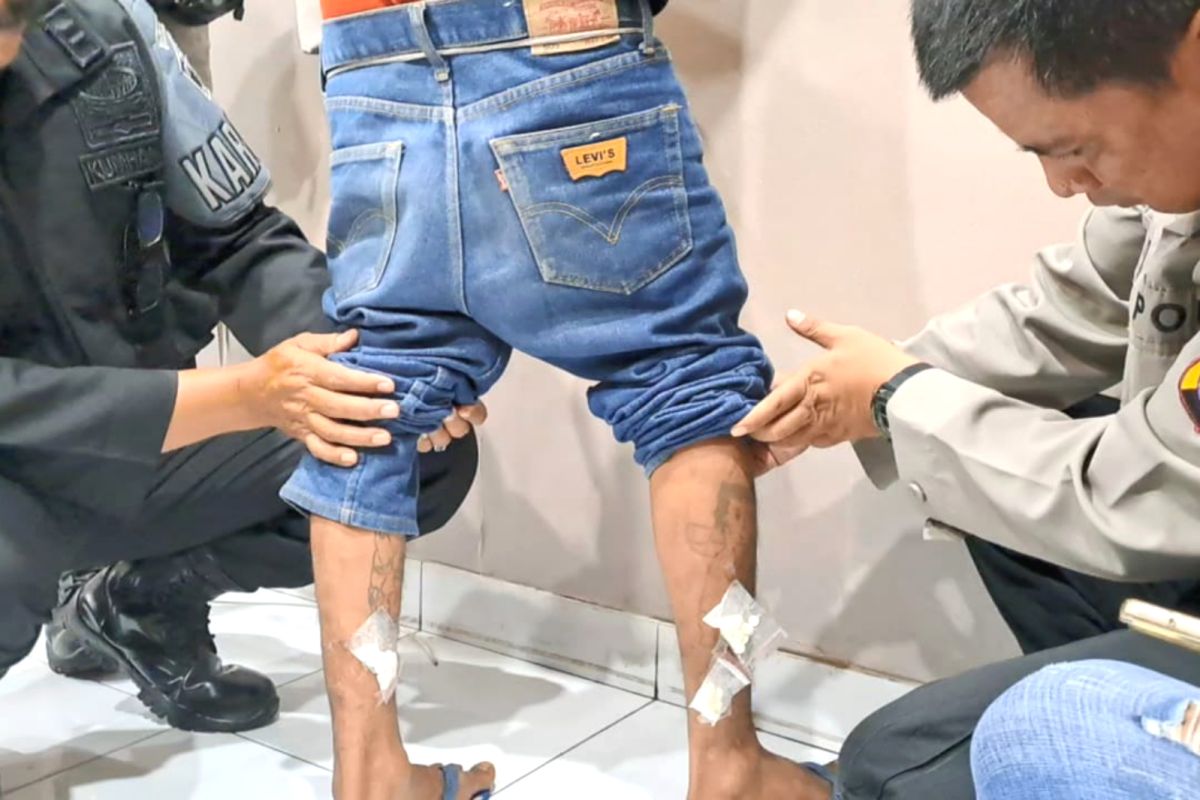 Penyelundupan pil koplo di betis pengunjung Lapas Yogyakarta digagalkan petugas
