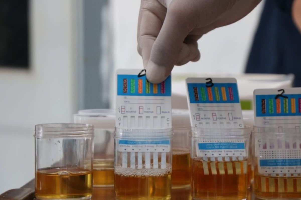 BNN-Daop 9 tes urine petugas KAI pastikan bebas narkoba
