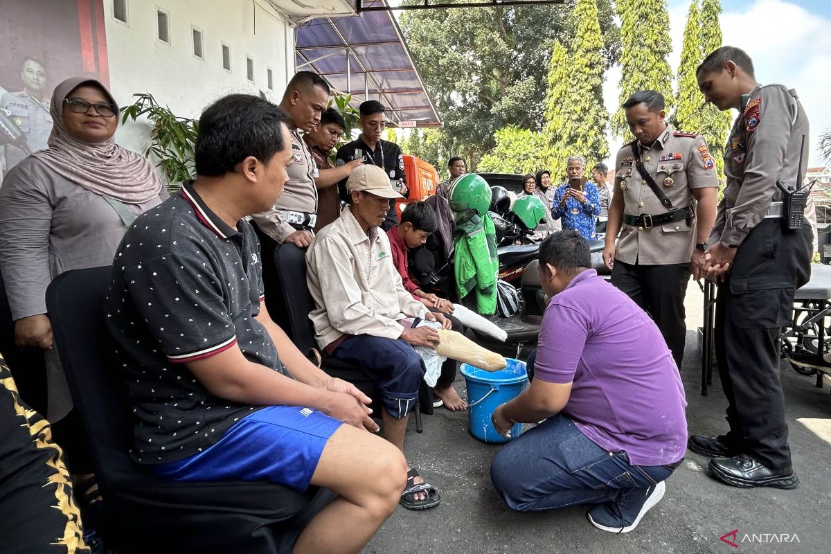 Polresta Malang Kota fasilitasi pembuatan kaki palsu bagi disabilitas