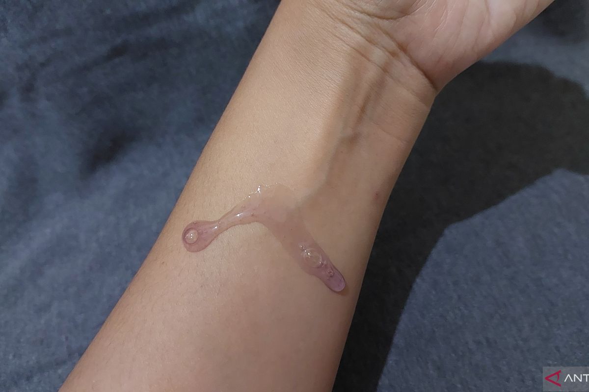 Dermatolog menjelaskan mengapa eksfoliasi kulit tak boleh berlebihan