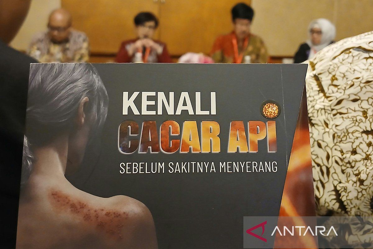 Satgas imunisasi dewasa sebut pentingnya vaksinasi cacar api