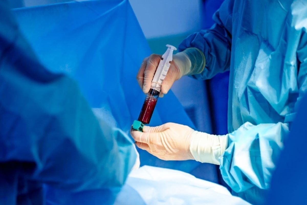 Transplantasi sel punca darah membebaskan Talasemia Mayor dari transfusi