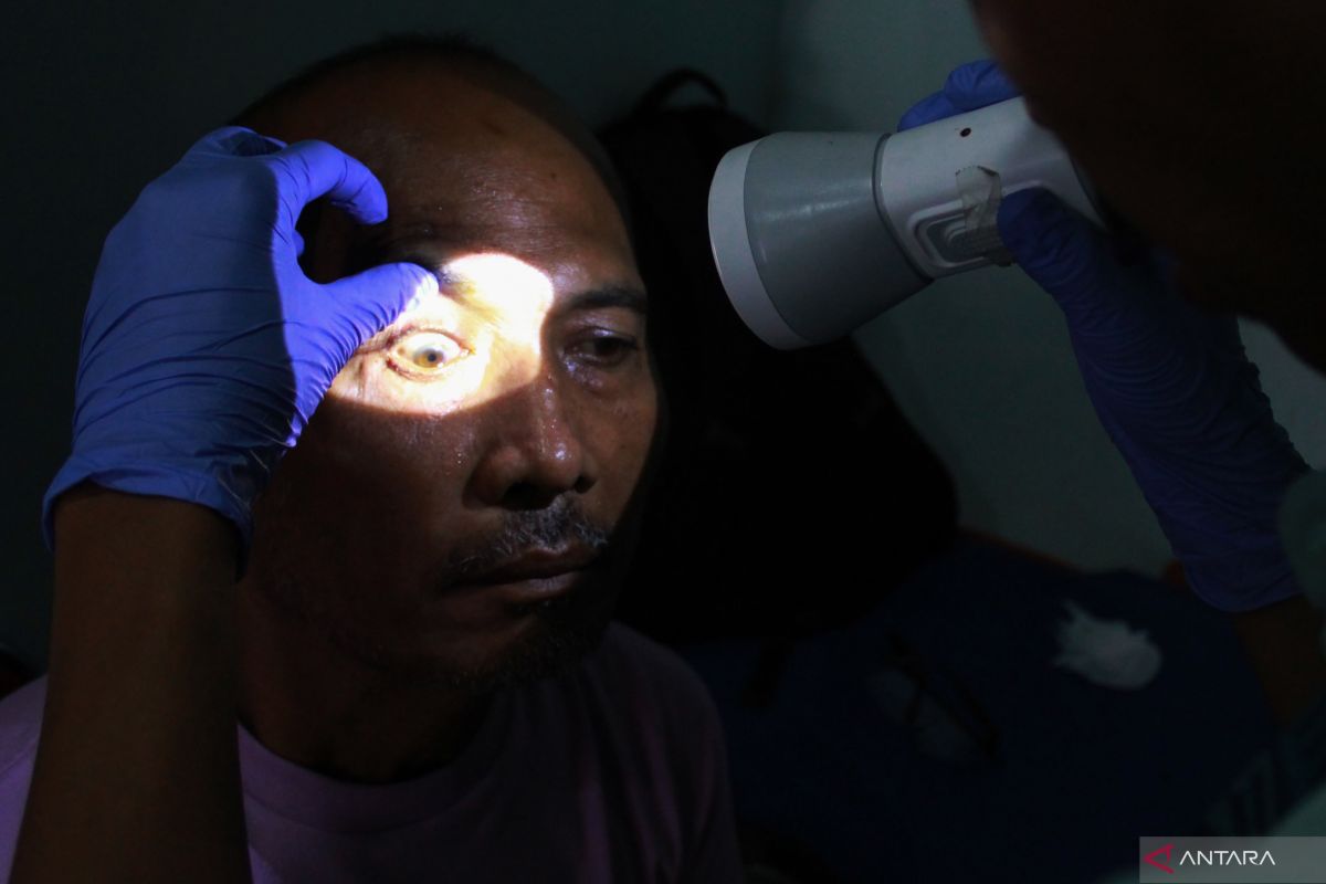 Cara mengobati sakit mata dengan bahan alami