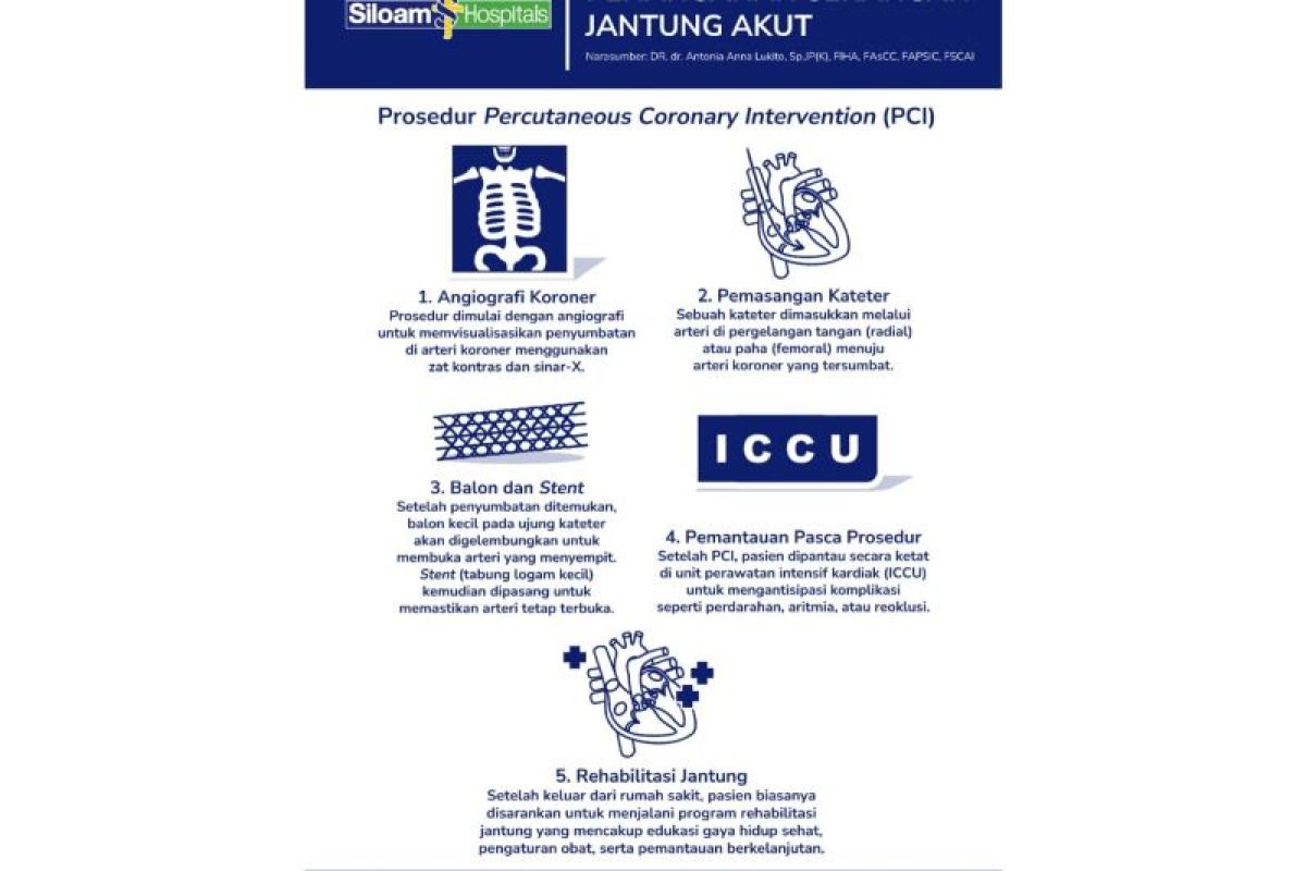 Mengenal  gejala dan prosedur PCI untuk serangan jantung akut