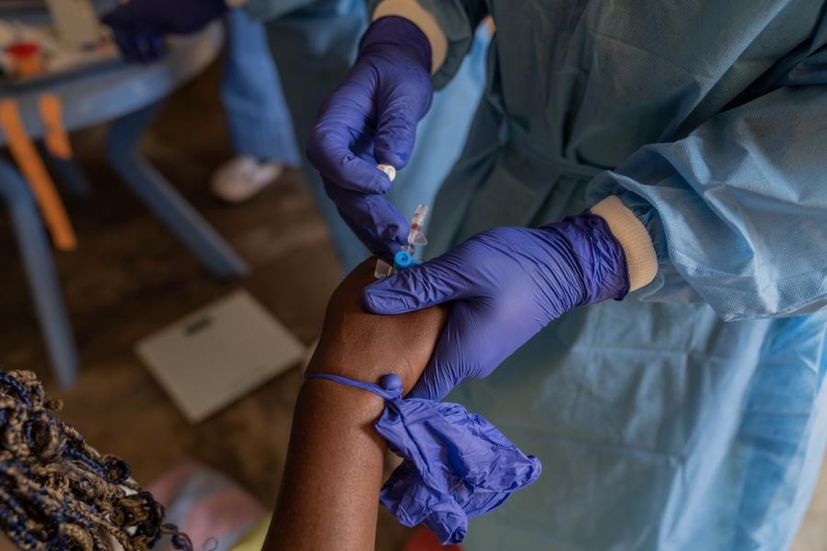 CDC: Mpox di Afrika nyaris mencapai 30.000 kasus