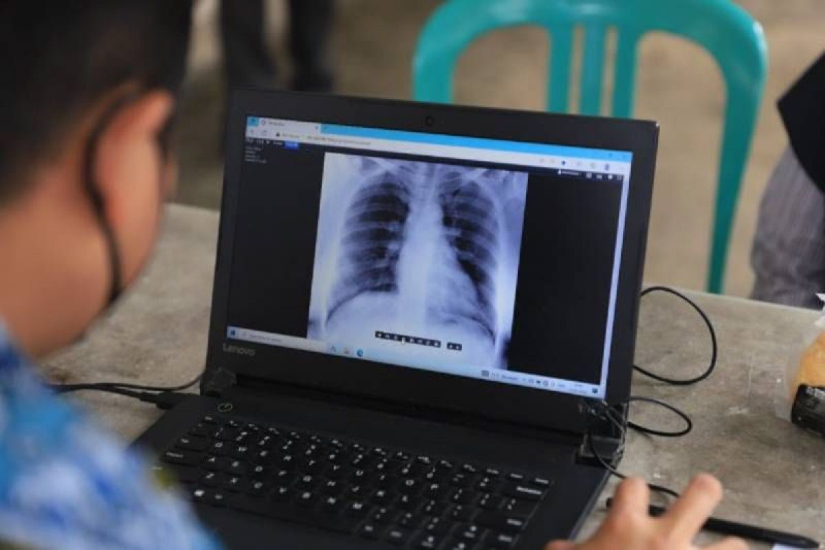 Dinkes dan RSUP Sitanala skrining penyakit TBC gunakan portable X-ray