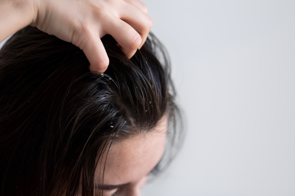 Ingin rambut sehat dan lebat? ini nutrisi yang perlu dipenuhi