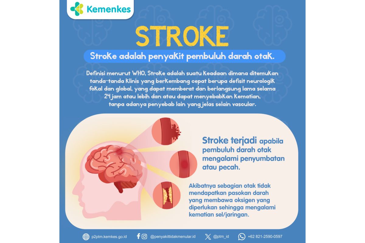 Ahli gizi ingatkan jaga diet sehat untuk cegah stroke berulang