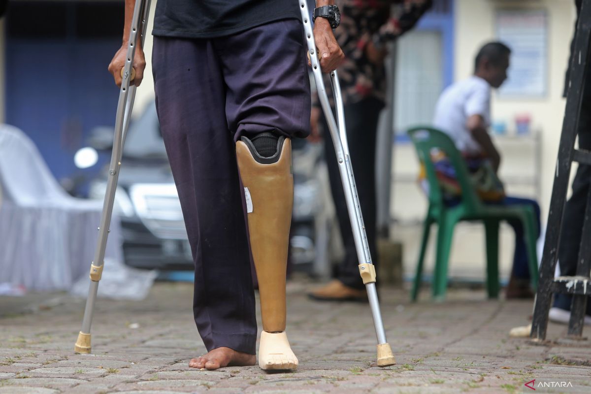 Baitul Mal siapkan Rp1 miliar zakat untuk bantuan kaki palsu di Aceh