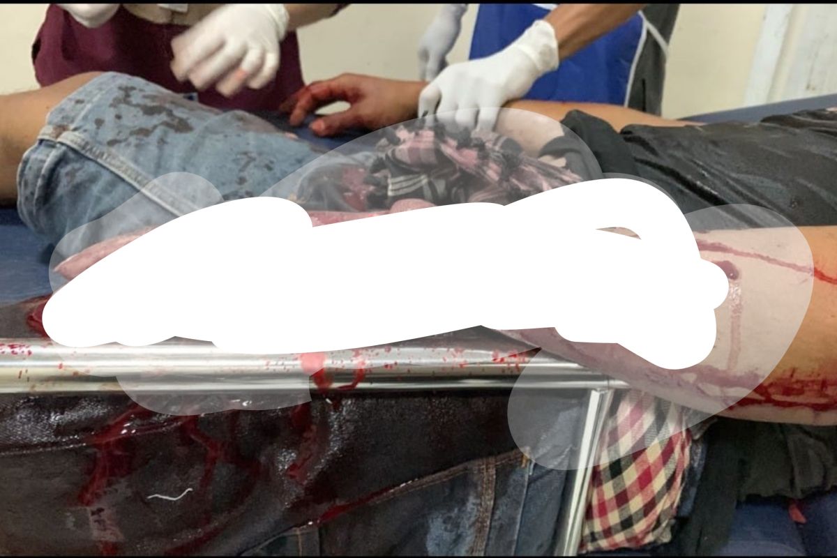 Polisi buru pelaku pengeroyokan warga di Lombok Timur