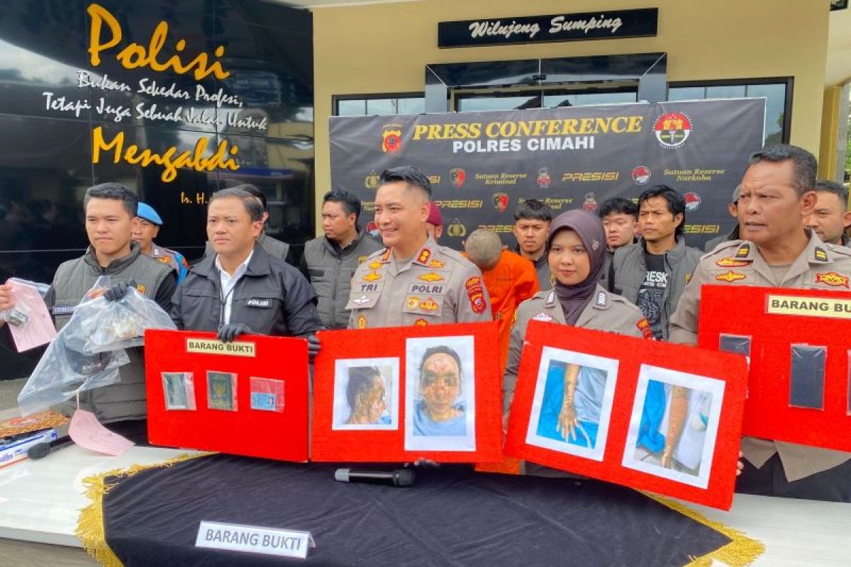 Pelaku penyiraman air keras terhadap istrinya berhasil ditangkap
