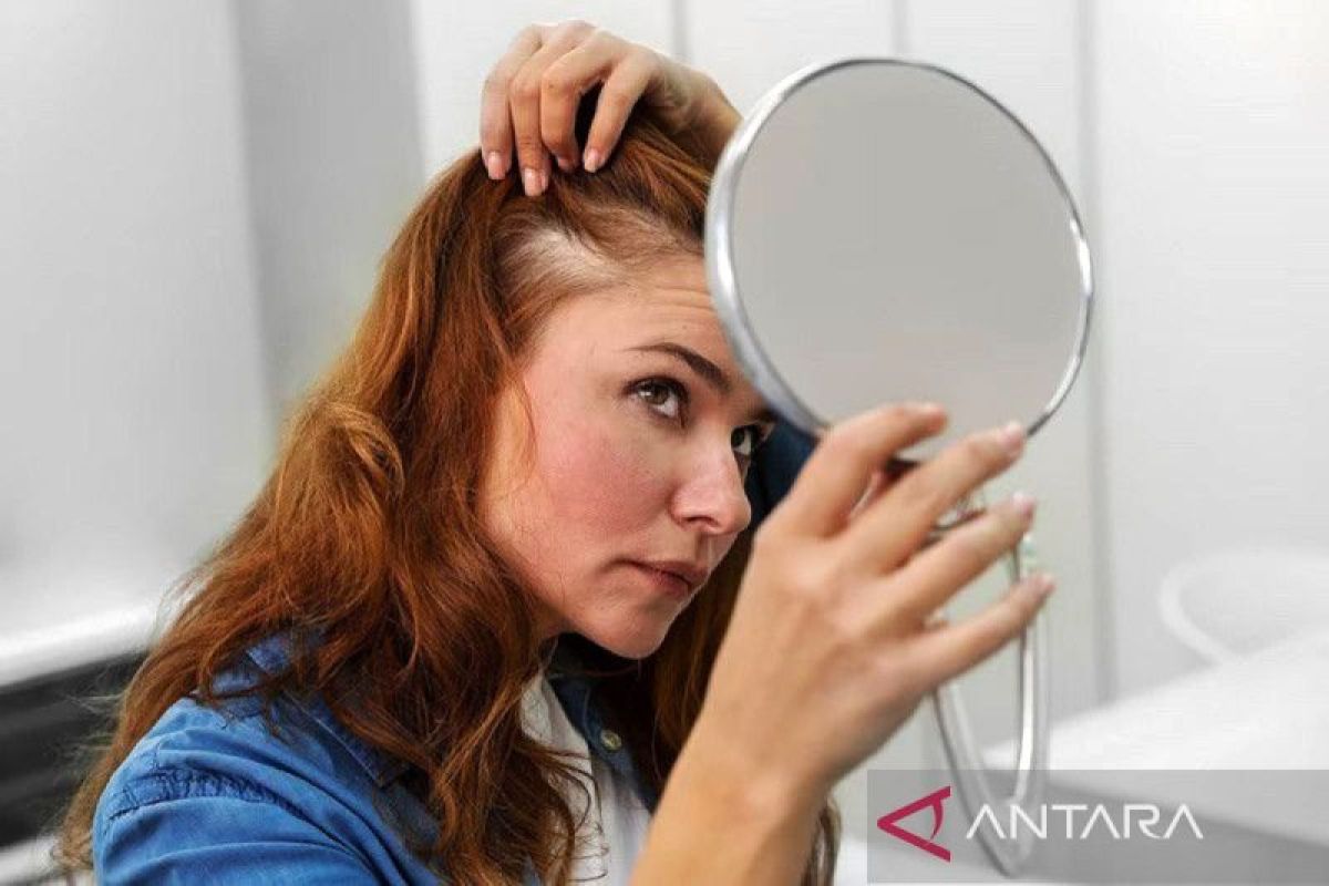 FDA peringatkan efek samping serius obat penumbuh rambut populer di AS