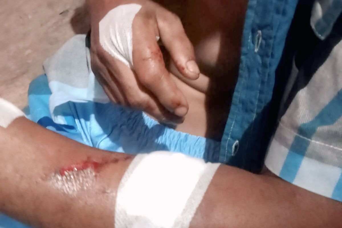 BPBD Tanjungpinang minta warga waspada serangan buaya di pesisir