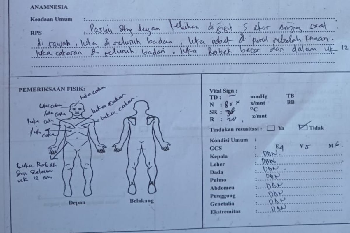 Lombok Tengah tangani anak digigit lima anjing liar
