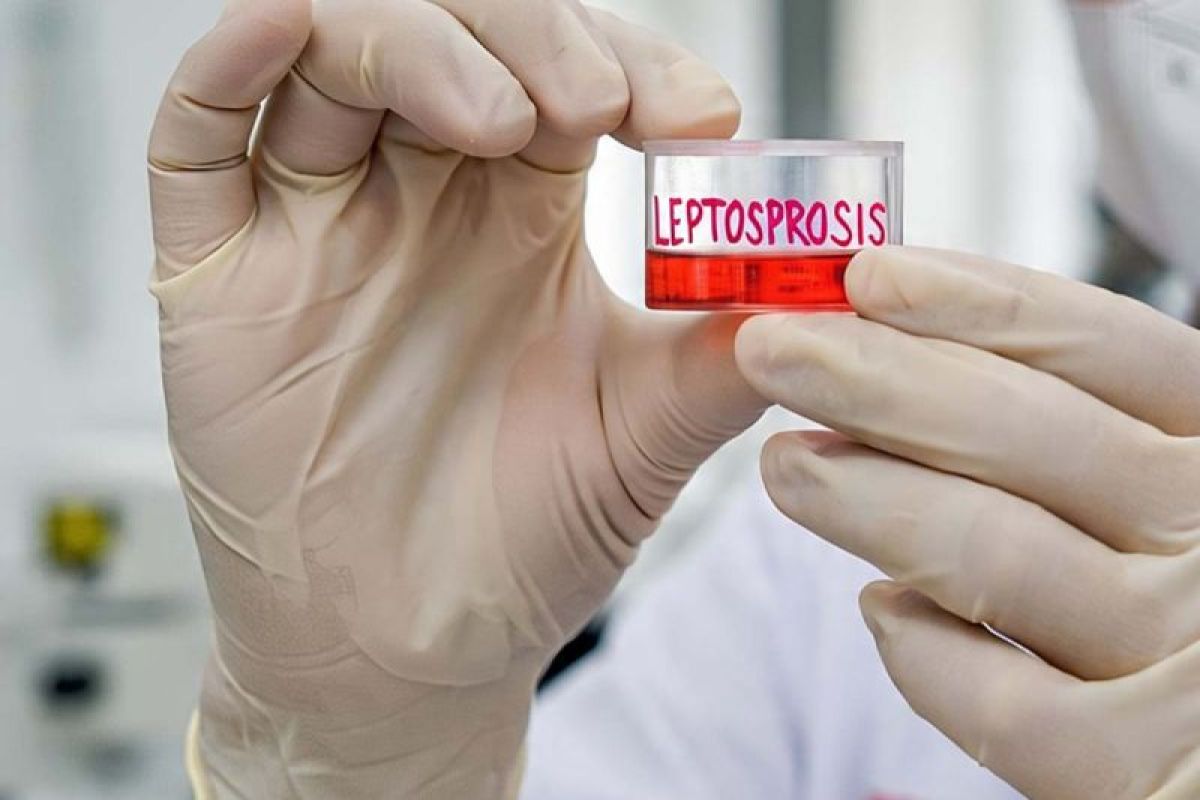 Per 4 Juli 2025, ada 859 kasus suspek leptospirosis di Jateng
