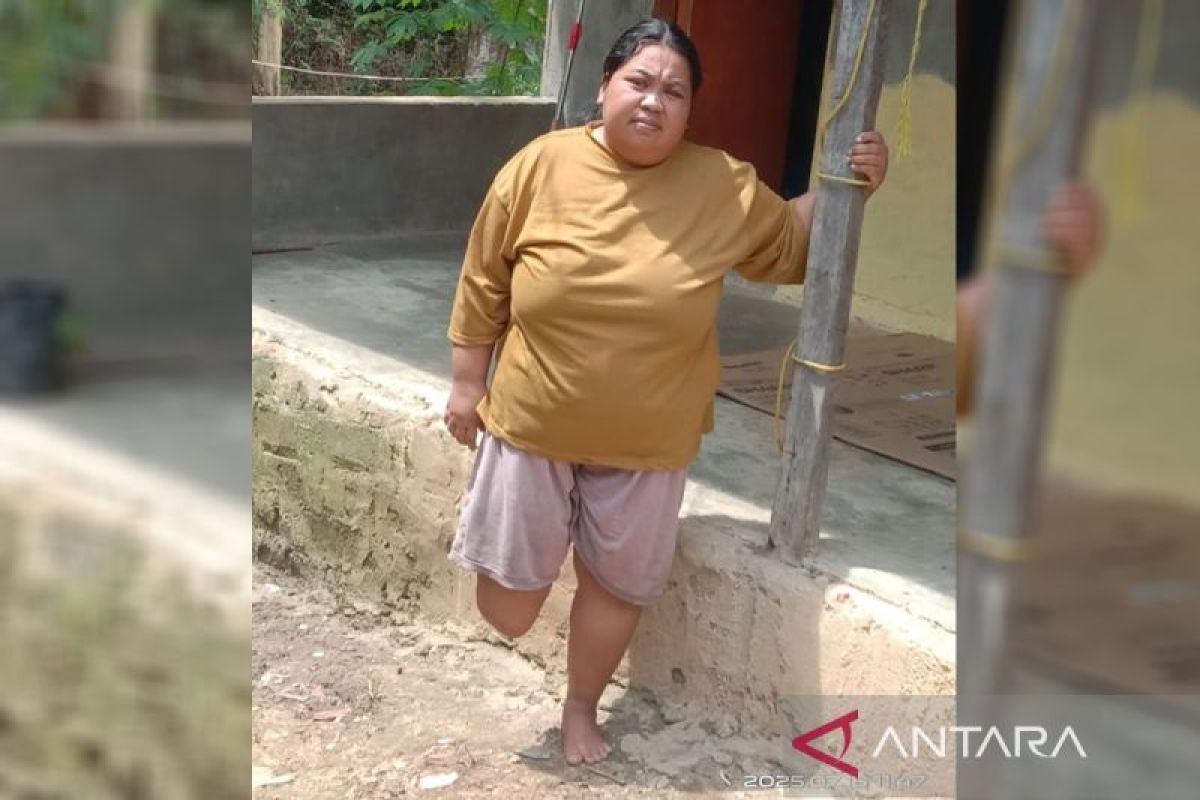 Penyandang disabilitas di Kotim butuh uluran tangan pemerintah dan dermawan