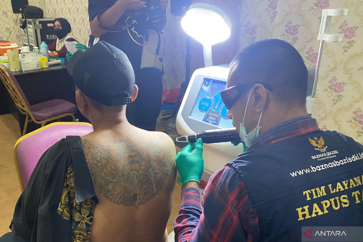 Bahagianya Ahmad bisa hapus tato gratis di Jakarta Selatan
