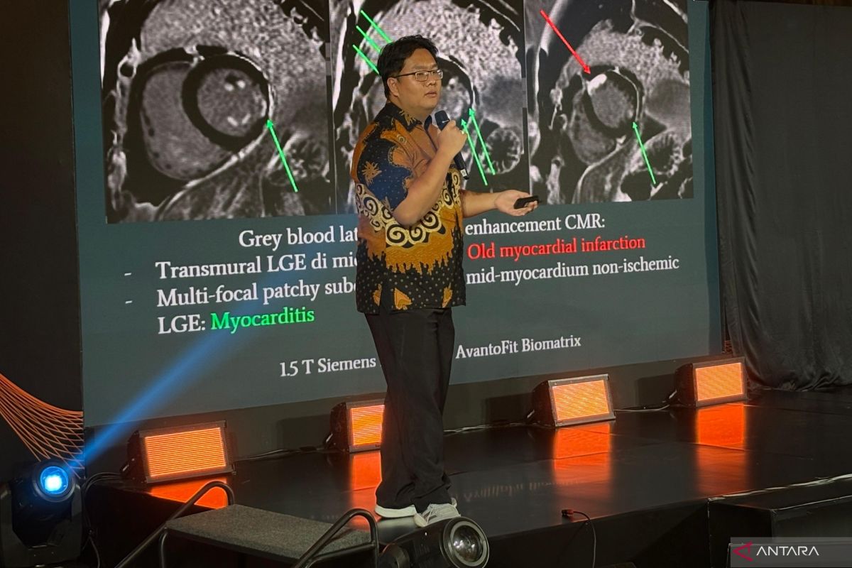 Tantangan mengembangkan sistem MRI di Indonesia