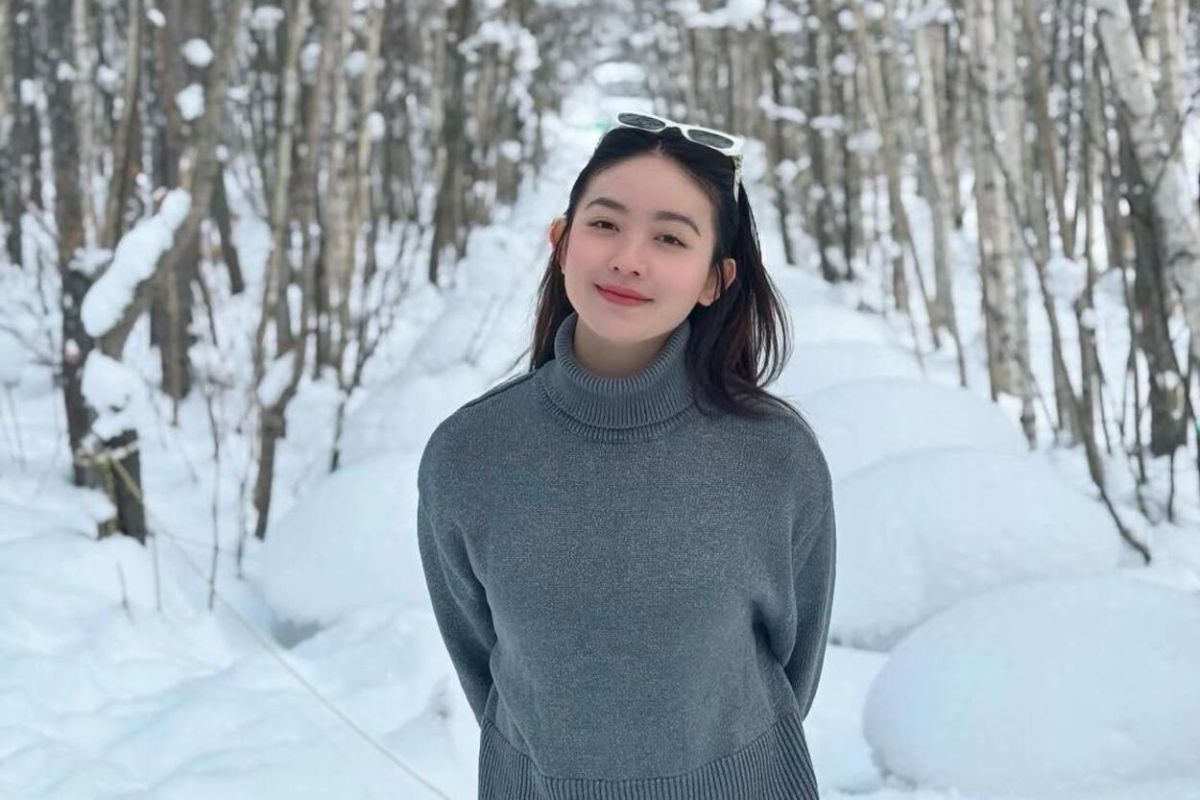 Natasha Wilona cerita cara tetap positif saat kulit wajah “breakout