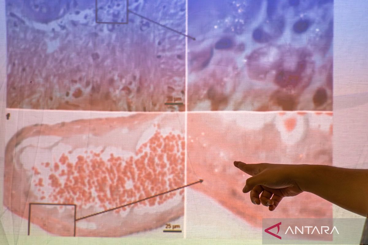 Ahli bagikan kiat meminimalisasi paparan mikroplastik rumah tangga