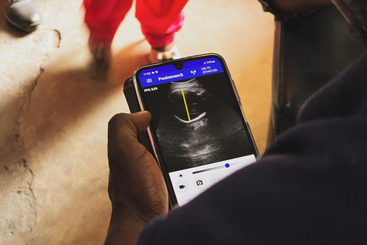 Ultrasound portabel beri harapan ibu hamil di Kongo yang masih konflik