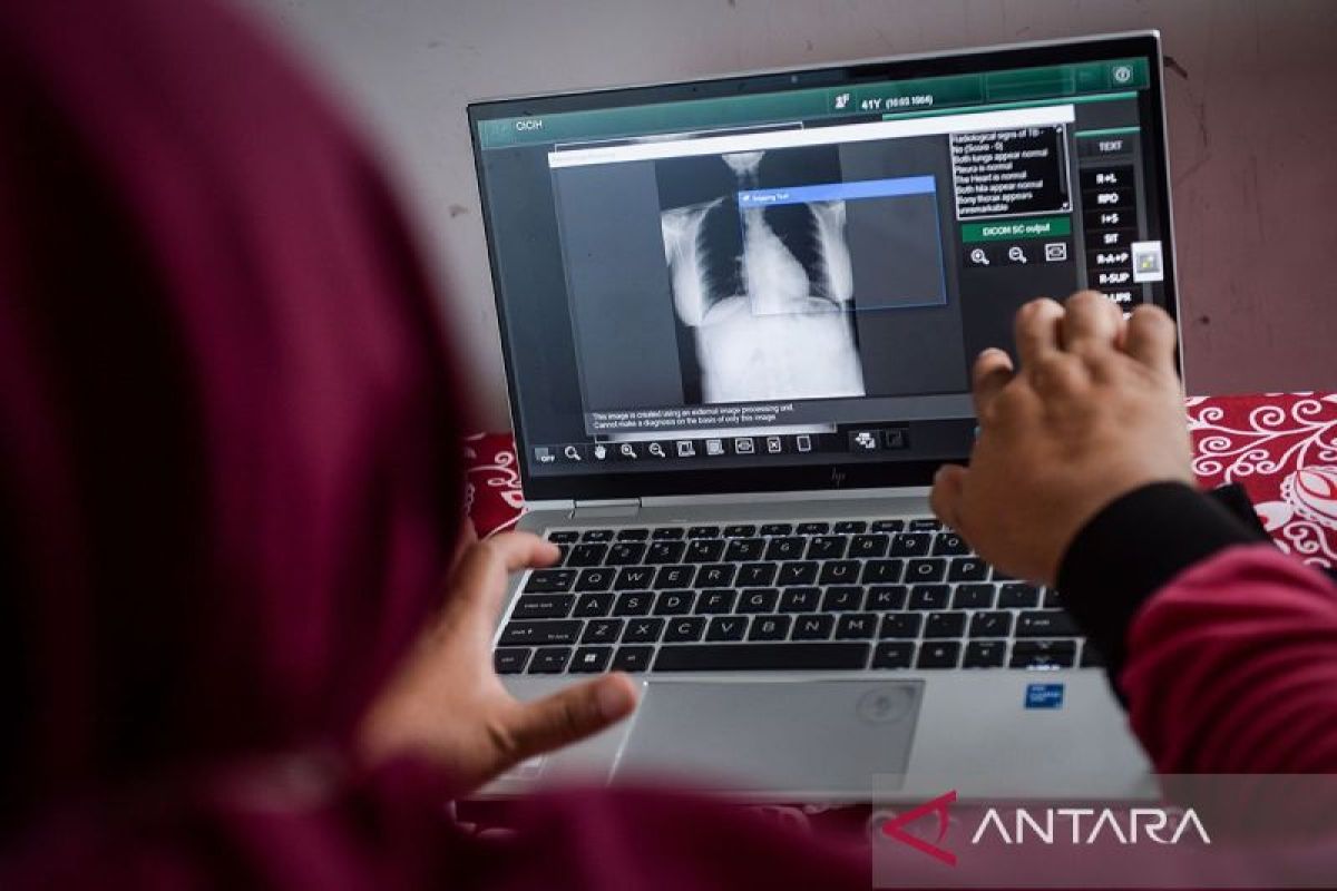 RI tambah anggaran khusus untuk percepatan deteksi TBC pada 2026