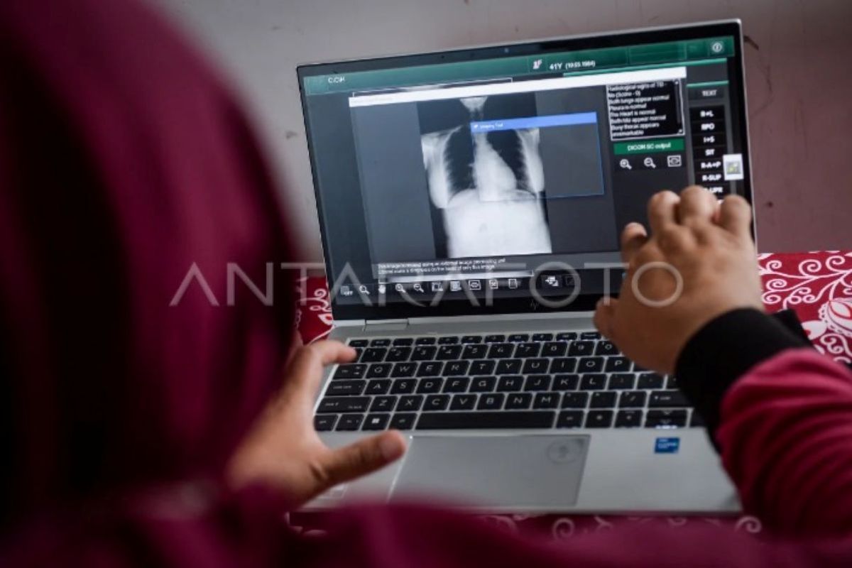 Indonesia Tingkatkan Anggaran untuk Percepat Deteksi Tuberkulosis pada 2026