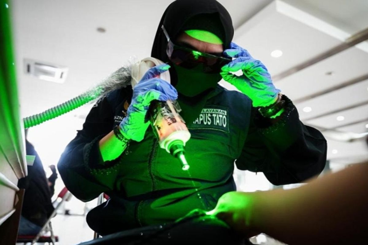 Jumlah peminat layanan hapus tato gratis di Jakbar lebihi kuota