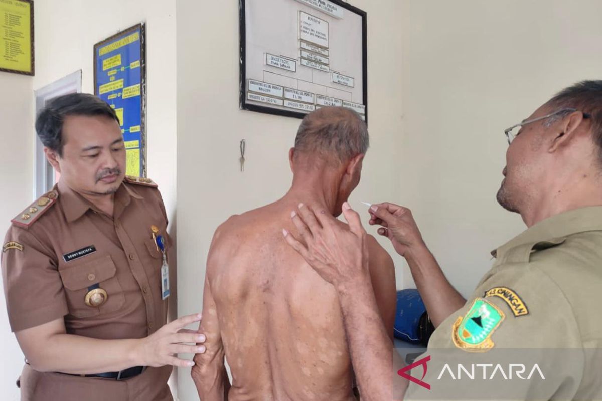 Mengikis stigma untuk eliminasi penyakit terabaikan bernama kusta