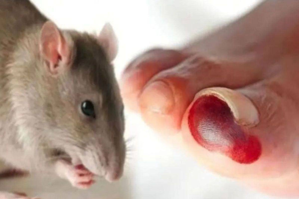 Awas! Virus Hanta Mengintai dari Debu Kotoran Tikus