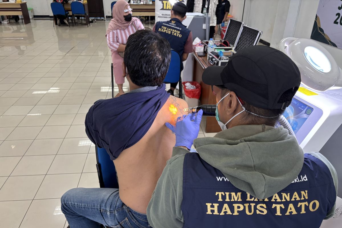 Seratus warga Jakut ikuti hapus tato gratis di Kantor Walkot