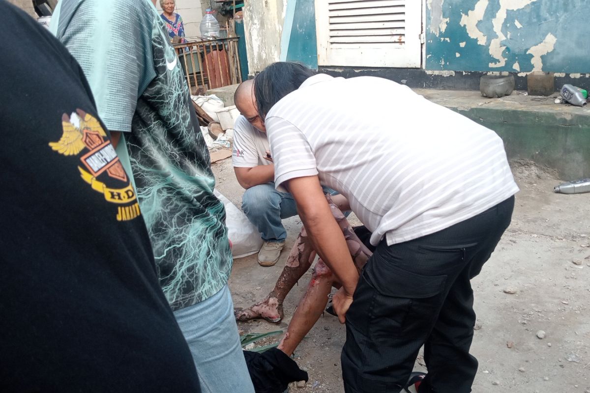 Pria di Jakut alami luka bakar akibat tersengat listrik saat mencuri