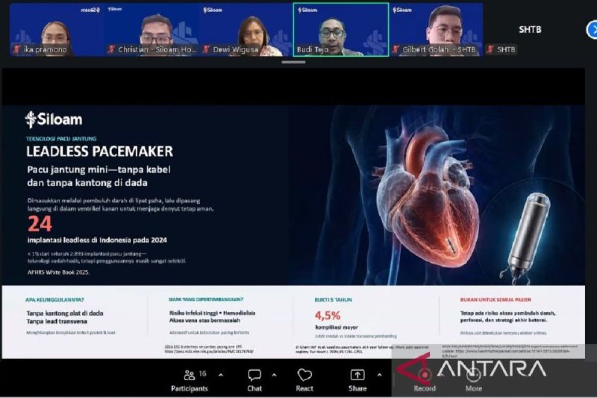 Dokter Rekomendasikan Alat Pacu Jantung Tanpa Kabel untuk Aritmia