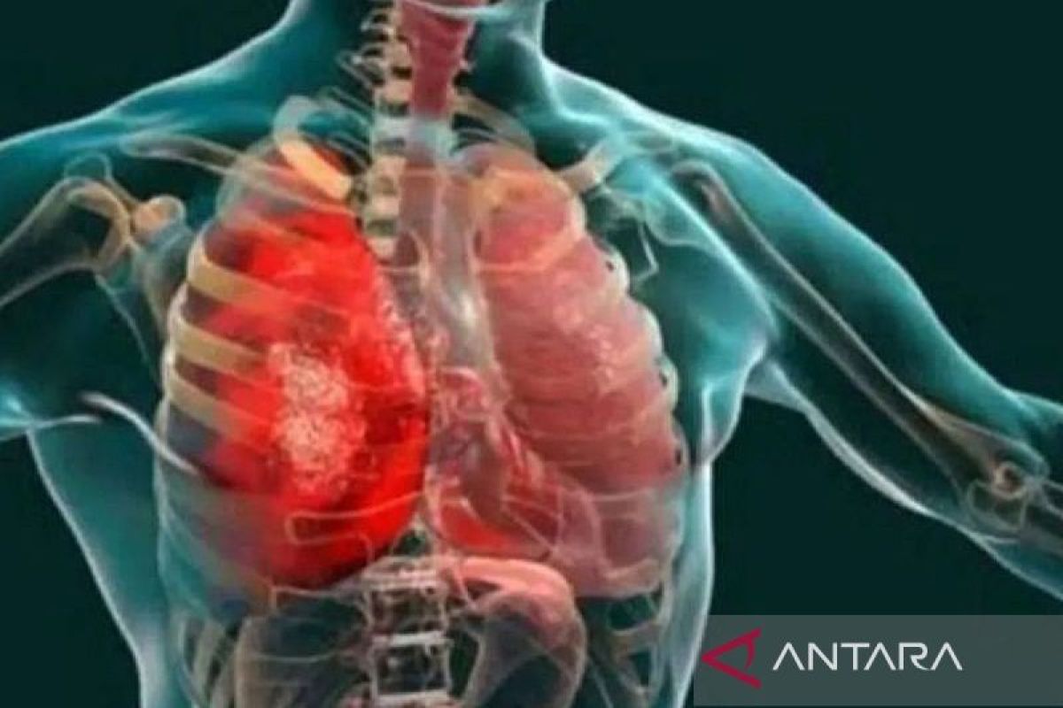 Otoritas Rusia sebut tak ada risiko epidemi kasus pneumonia di Irkutsk — NadiKabar.com
