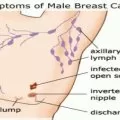 Biopsi Tak Akan Perburuk Tumor Jinak Atau Ganas Antara News<script async src=