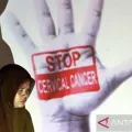 Dokter bilang Vaksin HPV bagi laki-laki untuk cegah kanker serviks pasangannya