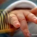 Polres Bima menelusuri dugaan malapraktik akibatkan bayi diamputasi