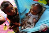 BAYI PENDERITA HYDROCEPHALUS. Bayi dari pasangan Andi dan Emi, Sahrul Ilham (4 bulan), berada di ayunan di rumahnya, di Dusun Punggur Besar, Kecamatan Sungai Kakap, Kabupaten Kubu Raya, Kalbar, Minggu (19/2). Sahrul Ilham yang menderita hydrocephalus sejak berusia tiga bulan tersebut, telah dibawa oleh orangtuanya ke Rumah Sakit Umum Daerah (RSUD) di Pontianak untuk mendapatkan pengobatan. Namun hingga kini pihak RSUD belum juga melakukan perawatan pada bayi itu, hanya memberikan obat jalan berupa obat pereda panas. (FOTO ANTARA/Jessica Wuysang)