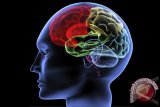  Peneliti Tumbuhkan Otak Mini Dari Sel Punca Manusia