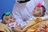 Perawat memegang bayi kembar siam Rahma-Rahmi di Rumah Sakit Moehamad Husein Palembang, Sumsel, Rabu (12/6). Rahma dan Rahmi yang lahir tahun lalu itu akan menjalani operasi pemisahan pada sabtu (15/6). ANTARA FOTO/Feny Selly/nym/2013.
