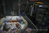 Kondisi bayi perempuan kembar siam dempet perut (omphalopagus) yang dirawat di RSUD dr Soetomo, Surabaya, Jawa Timur, Selasa (9/1). Bayi kembar siam yang lahir pada 8 Januari 2018 dan diberi nama Salma dan Sofia tersebut lahir secara prematur yaitu sekitar 37 dan 38 minggu dan memiliki berat 4.950 gram. Antara Jatim/Zabur Karuru/zk/18 