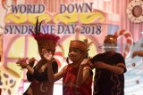 Sejumlah penyandang Down Syndrome mementaskan seni pada puncak peringatan Hari Down Syndrome Dunia 2018 di Surabaya, Jawa Timur, Rabu (21/3). Peringatan yang diikuti oleh ratusan penderita Down Syndrome dengan bertemakan 'What I Bring to My Community'tersebut memberikan kesempatan untuk menunjukkan kreativitas dalam bidang seni guna meningkatkan kesadaran publik kedepannya. Antara Jatim/M Risyal Hidayat/zk/18