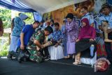 Bantuan kaki palsu gratis