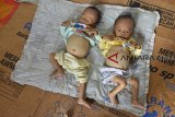 Bayi kembar pasangan Samin (40) dan Neni (32) bernama Nazar dan Nizar berbaring di atas kardus di rumah kontrakan di Kampung Bojong Salak, Desa Mangungjaya, Kabupaten Tasikmalaya, Jawa Barat, Kamis (18/10). Bayi kembar yang berumur 15 bulan dan memiliki berat badan 4,8 kilogram dan 5,3 kilogram tersebut telah menderita gizi buruk sejak berusia tiga bulan dan hingga saat ini pihak Dinas kesehatan dan Pemerintah setempat belum melakukan penanangan dan perawatan terhadap bayi tersebut. ANTARA FOTO/Adeng Bustomi/agr
