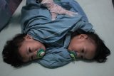 Tim medis menyelimuti Aqila dan Azila kembar siam asal Kendari, Sulawesi Tenggara di Instalansi Rawat Inap (Irna) anak RSUD Dr Soetomo Surabaya, Jawa Timur, Rabu (14/8/2019). Kembar siam dempet dada dan perut itu menjalani operasi pemisahan pada hari ini di Gedung Bedah Pusat Terpadu (GBPT) di rumah sakit tersebut. ANTARA FOTO/Didik Suhartono/nym.